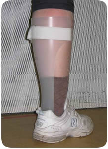 Ankle foot orthosis (AFO)
